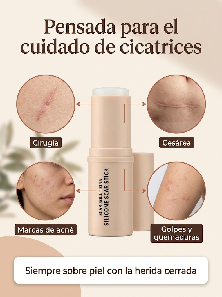 Tipos de cicatrices de cuidado: cirugía, cesárea, acné, golpes y quemaduras ya cerradas